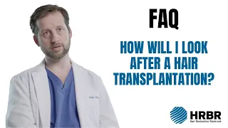 FAQ: How will I look following a hair transplant? - Hair Restoration Blackrock