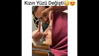 Kızın Yüzü Değişti Ya😳😍#kalbinesaklabeni #shorts #shortvideo#video #videos #humor#degisim#renoplasti