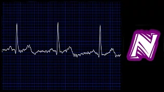 Heart monitor sound / EKG sound / Sound effect heart monitor