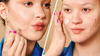 Get Unready With Me | Skincare for Acne-Prone Skin