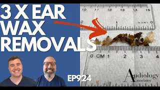 3 X EAR WAX REMOVALS - EP924