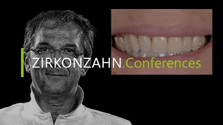 Dal parodonto alla zirconia – dalla clinica al laboratorio (Dr. Folegatti) | Zirkonzahn.Conferences
