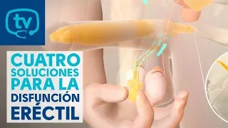 4 soluciones o tratamientos para la disfunción eréctil