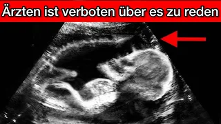 Arzt entdeckt in Bauch von Frau was niemand sehen sollte!