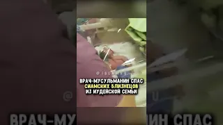 Сиамские близнецы