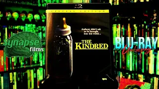 Synapse | THE KINDRED (1987) Blu-Ray Unboxing