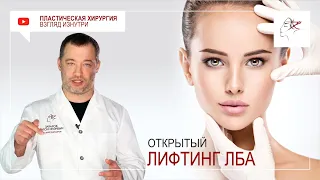 Открытый фронтотемпоральный лифтинг