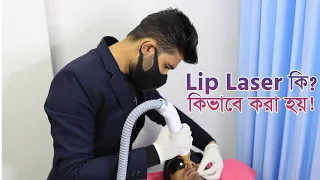 Lip Laser | Lips spot Remove | Lips Peel | Dhanmondi Laser Center