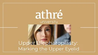 Marking an Upper Eyelid for a Blepharoplasty [Surgery Video]