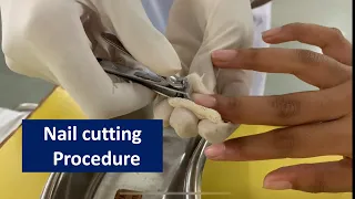 Nail cutting procedure for patient l Medical and Nursing l Rashmi Rajora