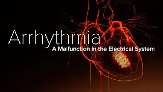 Heart Arrhythmia – Yale Medicine Explains