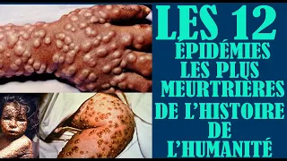 🇬🇳 12 épidémies les plus meurtrières de l’Histoire de l’Humanité 📺 DS VISION PROD