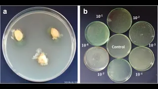 Assessment of Morphological and Biochemical Characterization of Endophytic Bacteria from Leaves