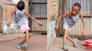 The Incredible Little Girl With Legs Like Scissors | BORN DIFFERENT