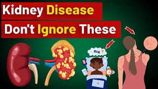 ⚠️10 Warning Signs You May Have Kidney Disease - Don't Ignore Them! Seek Medical Advice Immediately!