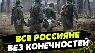 БЕЗ РУК И НОГ! Большинство россиян возвращаются из фронта без конечностей!