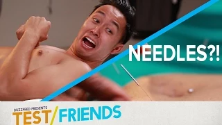 People Try Acupuncture Therapy • The Test Friends