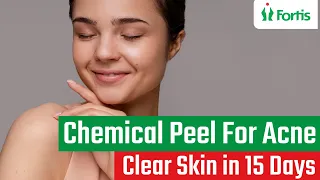 Part 2-Chemical Peel | Skin Peeling Treatment|Chemical Peel For Acne|Chemical Peel For Acne Scar|MUL