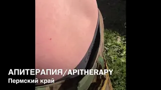 Апитерапия! Лечение пчёлами ! Apitherapy. Bee sting treatment. Народная медицина