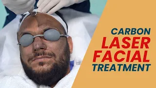 Carbon Laser Facial Treatment for Instant Glow | 🔴 Live Procedure | Carbon Laser Facial in Delhi