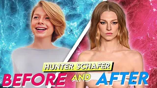 Hunter Schafer | Before & After | Plastic Surgery Transformation