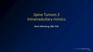 Spine tumors 3 – Intramedullary tumor mimics