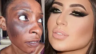 VIRAL BOMB 💣 BOLD🔥 Makeup Transformation🔥 Cirurgia Plastica 💉💉😳🔥😱 Makeup Tutorial