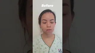 Full Face Transformation