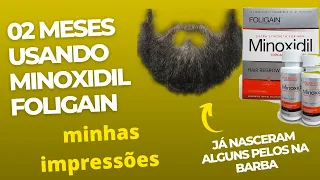 DICA PARA BARBA: Evolução da barba depois de 02 meses usando Minoxidil Foligain