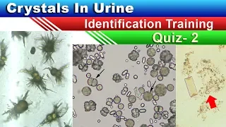 Crystals In Urine Identification Training Quiz ( Part 2/5 )