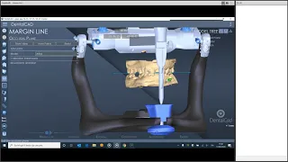 Live Webinar - 17th April 2020 - DentalCad Digital Articulator