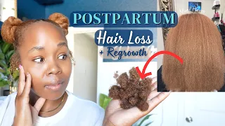 My Postpartum Hair Loss, Shedding & Regrowth | Real Tips & Essential Products!