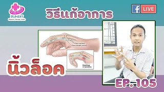 วิธีแก้อาการปวดนิ้วล็อค ง่ายๆด้วยตัวเอง | รักษาให้ตรงจุดกับบัณฑิต Ep.96