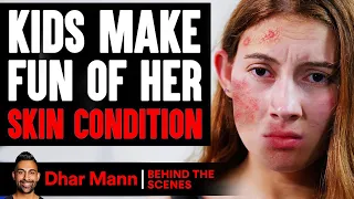 Kids MAKE FUN Of Girl's SKIN CONDITION (Behind The Scenes) | Dhar Mann Studios