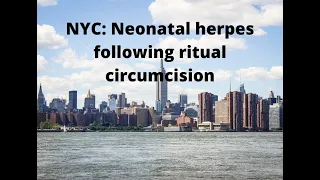 Neonatal herpes following ritual circumcision (metzitzah b'peh)