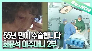 (Ep.2) 12 Hours of Major Surgery to Sperarate the Face and Neck