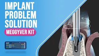 [New]MegGyver Kit Manual - How To Use