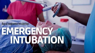 Emergency Intubation (RSI) in ER: step by step approach