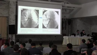 V Российская школа молодых специалистов. Рентгенэндоваскулярная эмболизация (6)