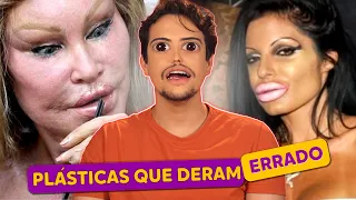 Plásticas dos famosos que DERAM ERRADO!