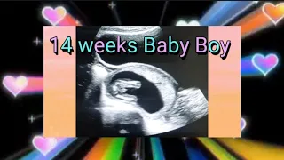 14 weeks baby boy 🔷️ ultrasound | 14 weeks fetus | pregnancy usg | How to tell gender on ultrasound