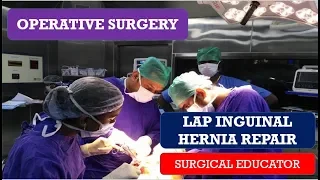 LAPAROSCOPIC INGUINAL HERNIA REPAIR-- STEP BY STEP  OPERATIVE SURGERY