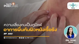 ผื่นแพ้ผิวหนังเรื้อรัง ความคันทรมานของคนเป็นภูมิแพ้ | โรงหมอ