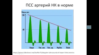 УЗДГ артерий НК.  Часть 1.  Характеристика допплеровского спектра артерий нижней конечности.