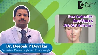 LASER Treatment for ACNE Scar|CO2 Fractional and MNRF Laser - Dr. Deepak P Devakar | Doctors' Circle
