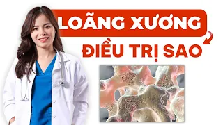 Loãng Xương Là Gì? Cách Điều Trị Loãng Xương- Hướng dẫn đọc kết quả đo mật độ xương | Dr Thùy Dung