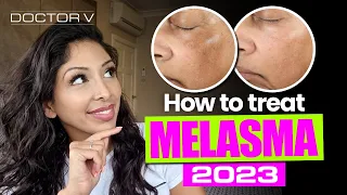 HOW TO TREAT MELASMA