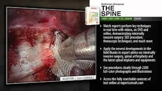 Rothman-Simeone: The Spine, 6th Edition