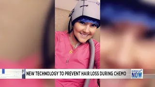 New technology to prevent hair loss during chemo