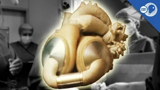 The Artificial Heart: Where did it come from? | Stuff of Genius